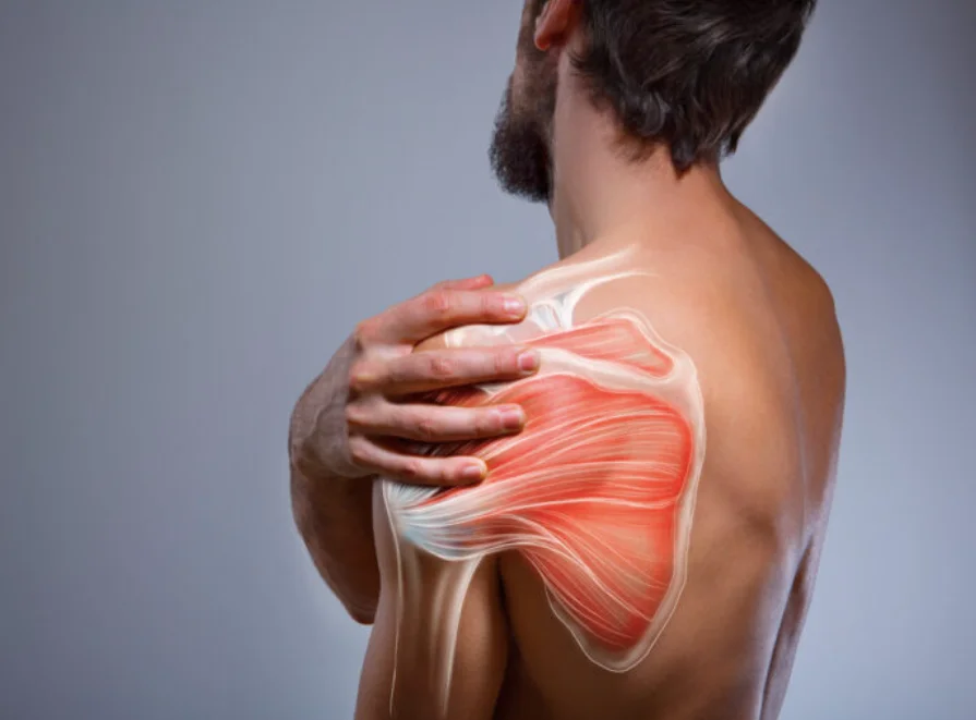 Shoulder Muscle Strain Anatomy Visual